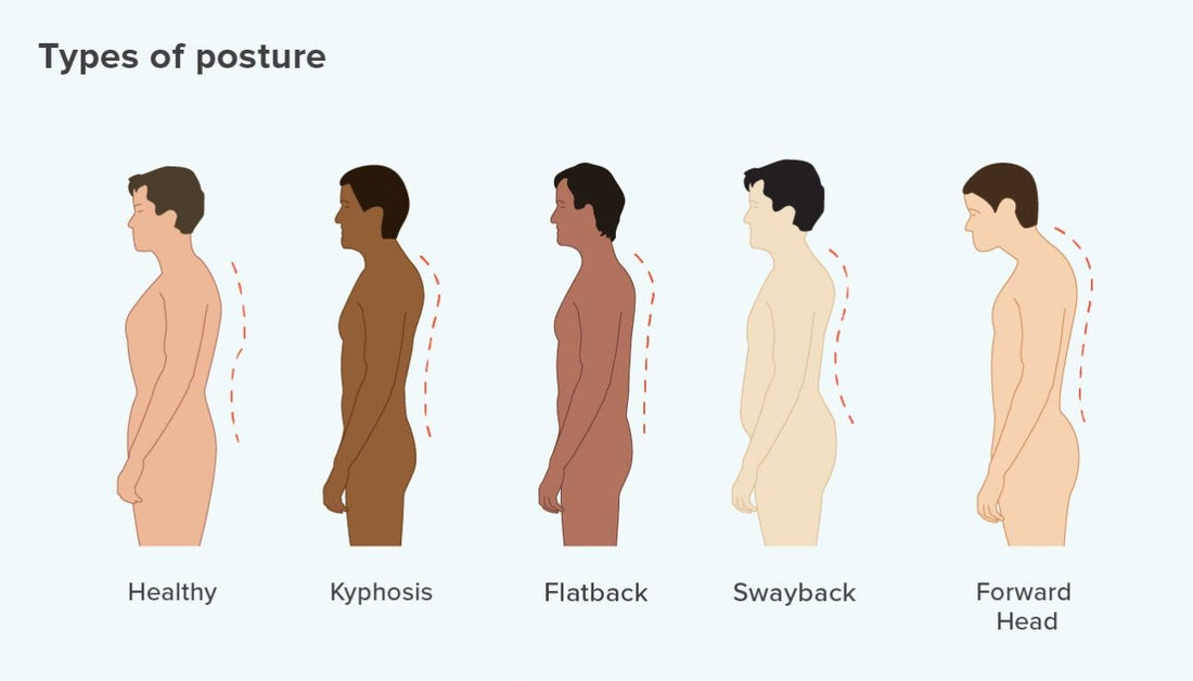 Different Types of Posture Correctors and Which One Is Right for You